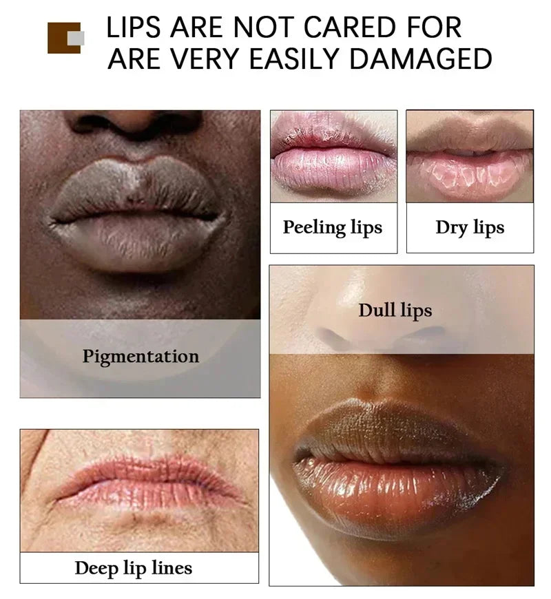 Remove Dark Lip Balm Moisturizing Lighten Melanin Bleaching Lip Gloss Lip Pink Lipstick Exfoliating Fade Lip Line Beauty Health