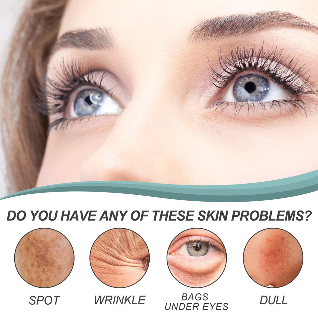 EELHOE Whitening Freckle Cream Nicotinamide Dark Spot Remover Skin Care Moisturizing Brighten Anti-aging Fade Spot Face Beauty