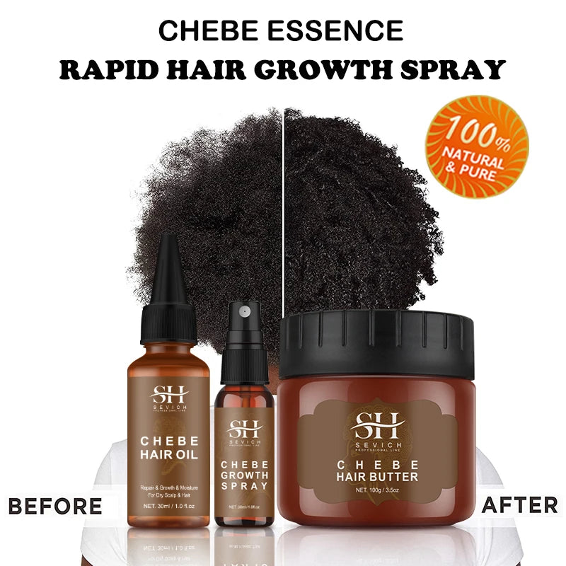 Sevich Chebe Fast Hair Growth Set — Oil 30ml + Mask 100g (Anti-Breakage & Traction Care)