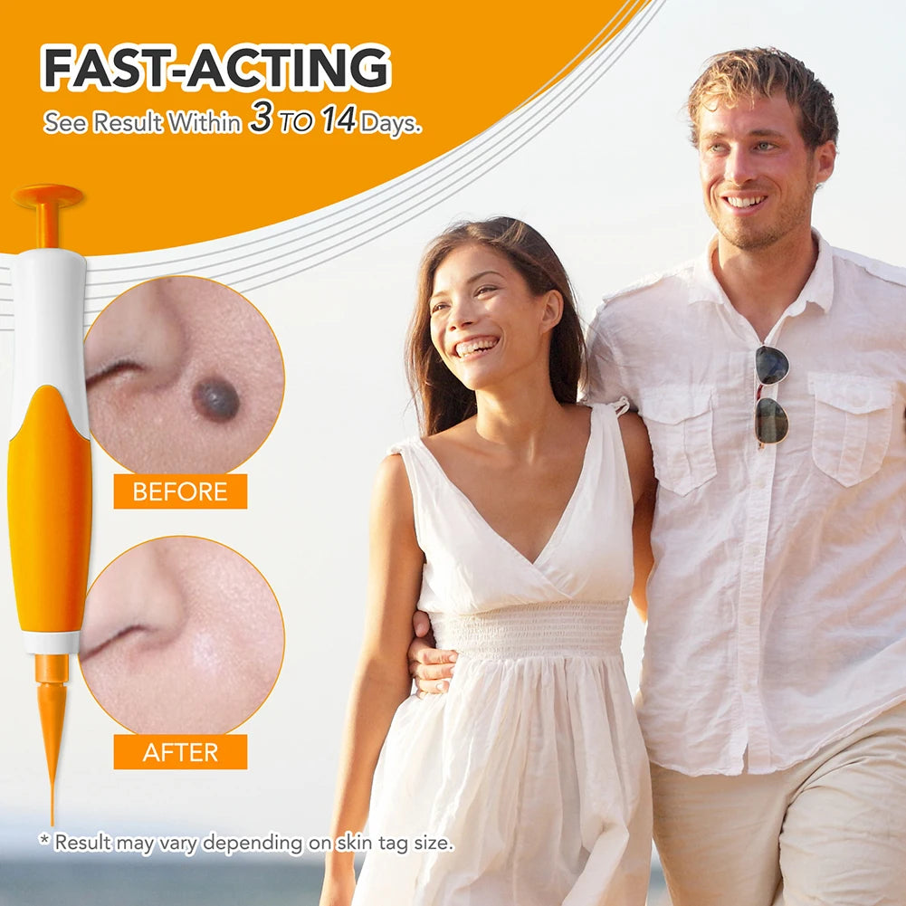 2 IN 1 Auto Micro Skin Tag Remover Device Standard And Micro Skin Tag Removal Kit Adult Mole Wart Remover Face Care Beauty Tools