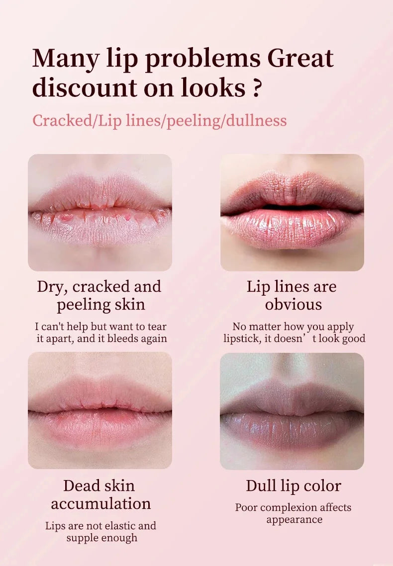 Remove Dark Lip Balm Moisturizing Lighten Melanin Bleaching Lip Gloss Lip Pink Lipstick Exfoliating Fade Lip Line Beauty Health