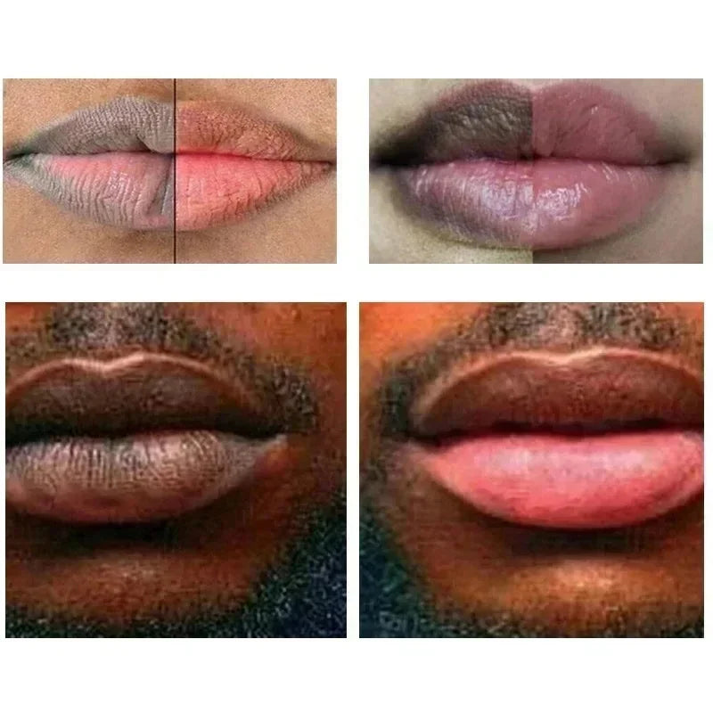 Remove Dark Lip Balm Moisturizing Lighten Melanin Bleaching Lip Gloss Lip Pink Lipstick Exfoliating Fade Lip Line Beauty Health
