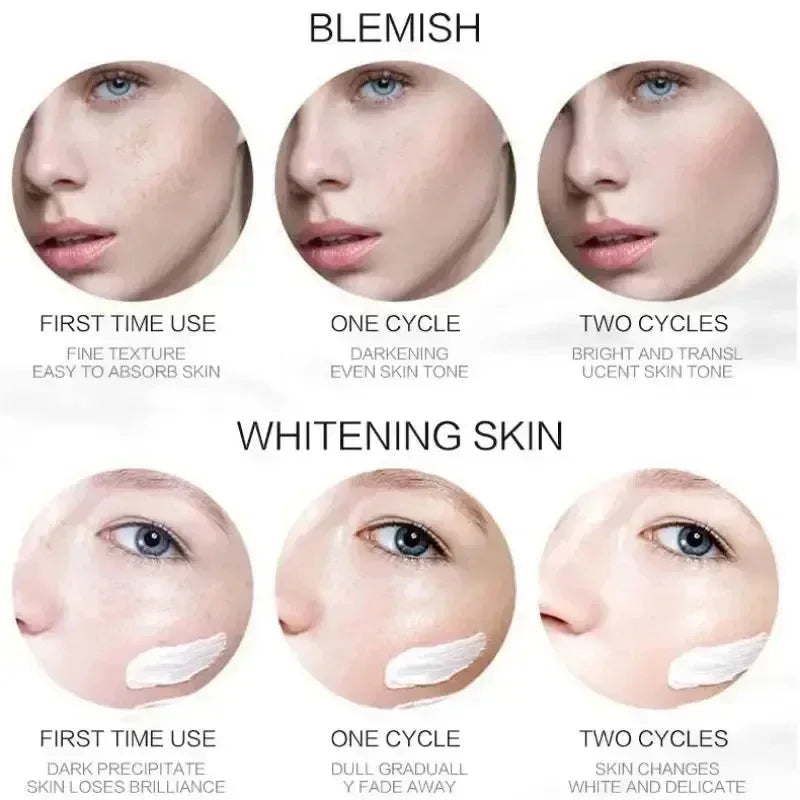 1/3/5pcs Whitening Freckle Cream Niacinamide Remove Dark Spot Cream Anti Freckle and Aging Cream Fade Pigmentation Melasma Skin