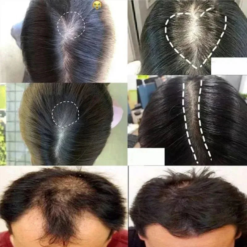 Fast Hair Growth Set Batana Oil Traction Alopecia Hair Mask Anti Break Loss Hair Growth Oil Baldness Treatment Hair Health Care