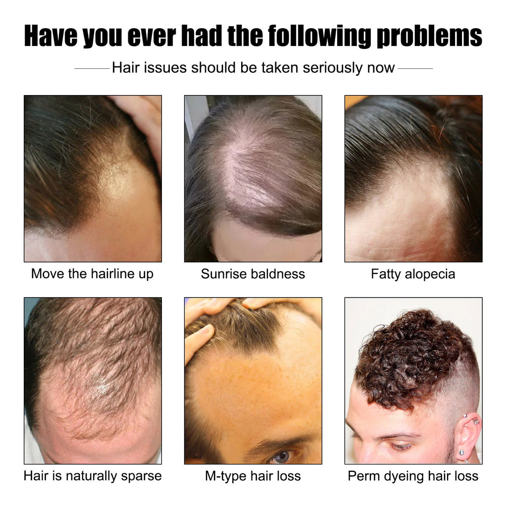 East Moon Vitamin E Hair Growth Oil – 30ml Hair Regrowth & Root-Strengthening Serum for Men