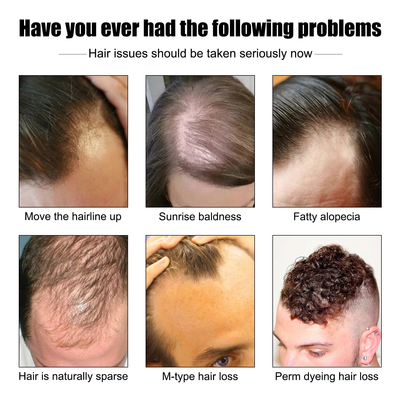 East Moon Vitamin E Hair Growth Oil – 30ml Hair Regrowth & Root-Strengthening Serum for Men