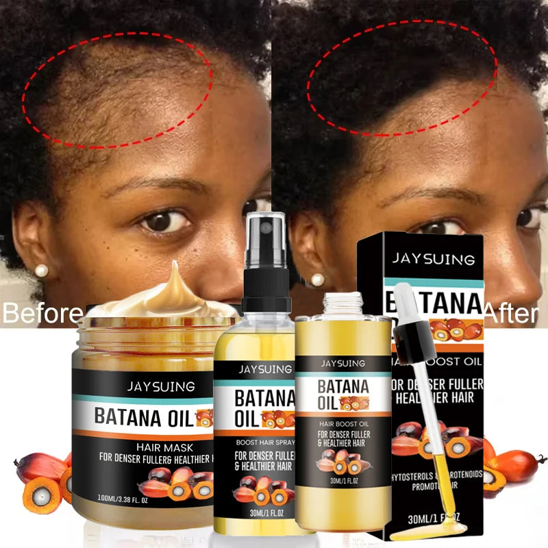 Fast Hair Growth Set – Batana Oil & Hair Mask for Traction Alopecia, Anti-Breakage & Baldness Repair (120g + 50ml)