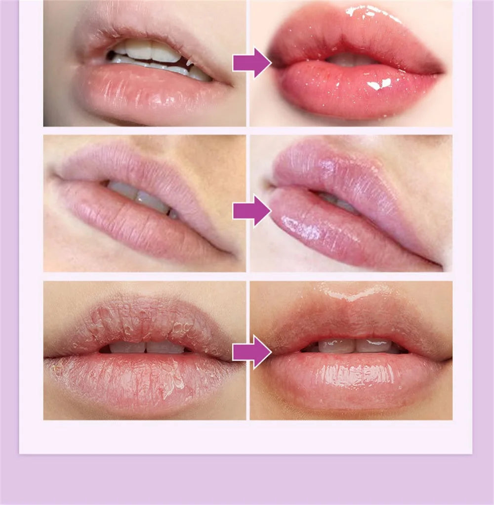 Remove Dark Lip Balm Fast Lightening Pink Lip Exfoliating Fade Lip Line Dead Skin Moisturizer Korean Care Products Beauty Health