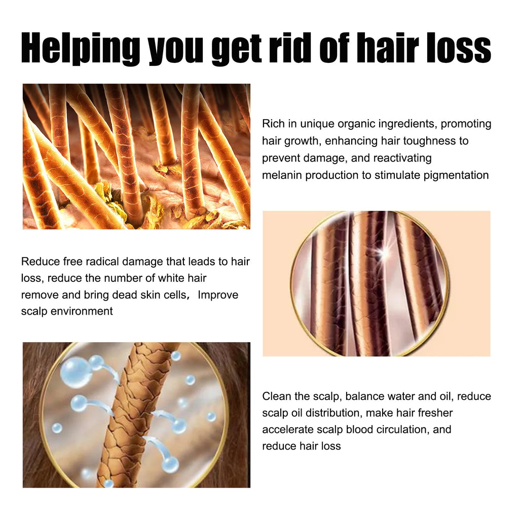 East Moon Vitamin E Hair Growth Oil – 30ml Hair Regrowth & Root-Strengthening Serum for Men