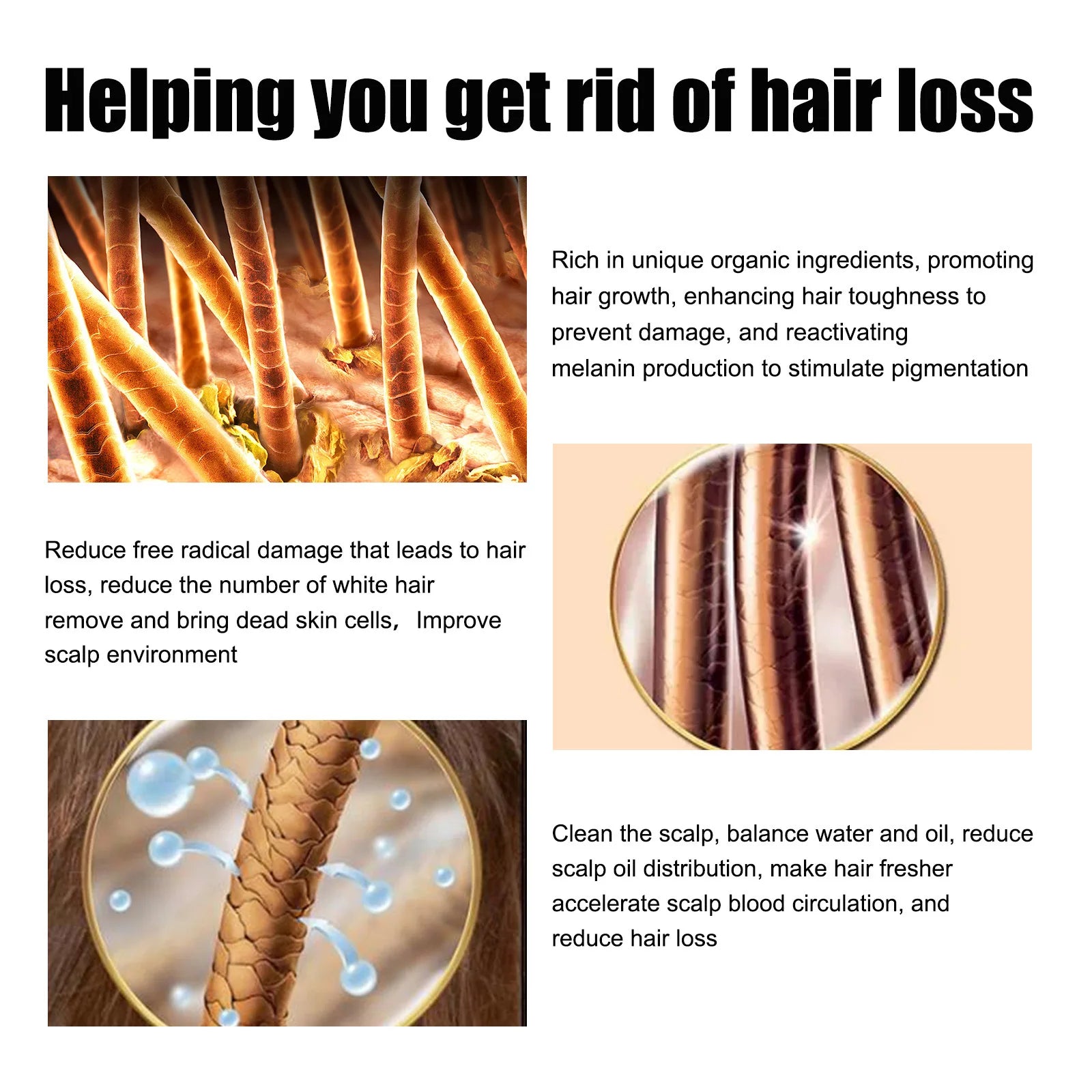 East Moon Vitamin E Hair Growth Oil – 30ml Hair Regrowth & Root-Strengthening Serum for Men